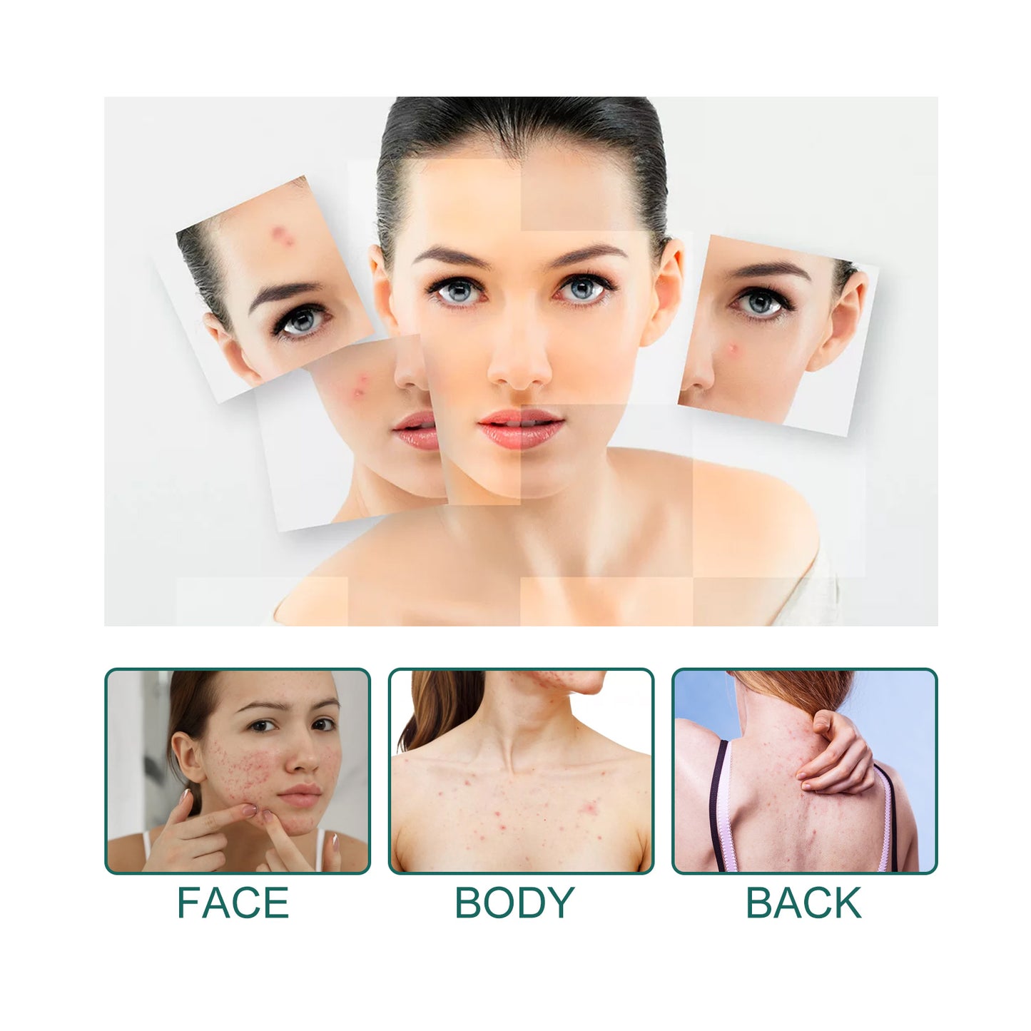 Invisible Pimple Patches