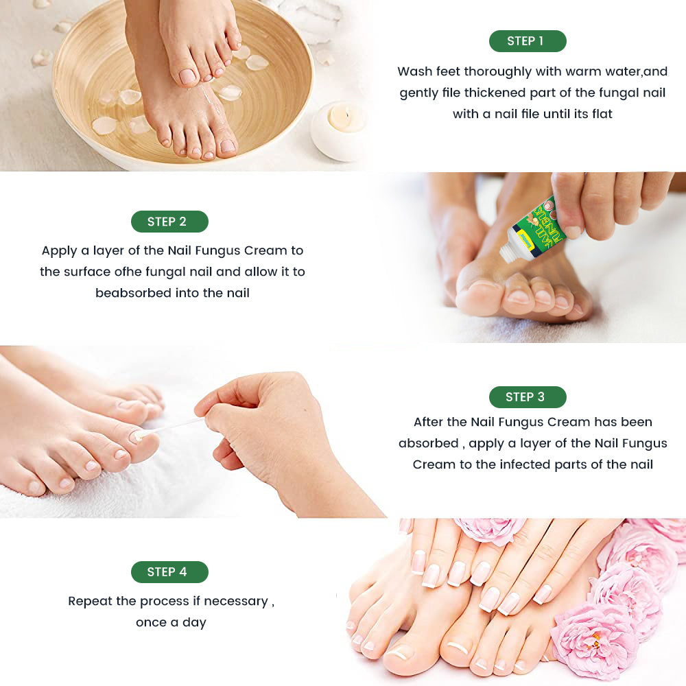 Nail Fungus Cream