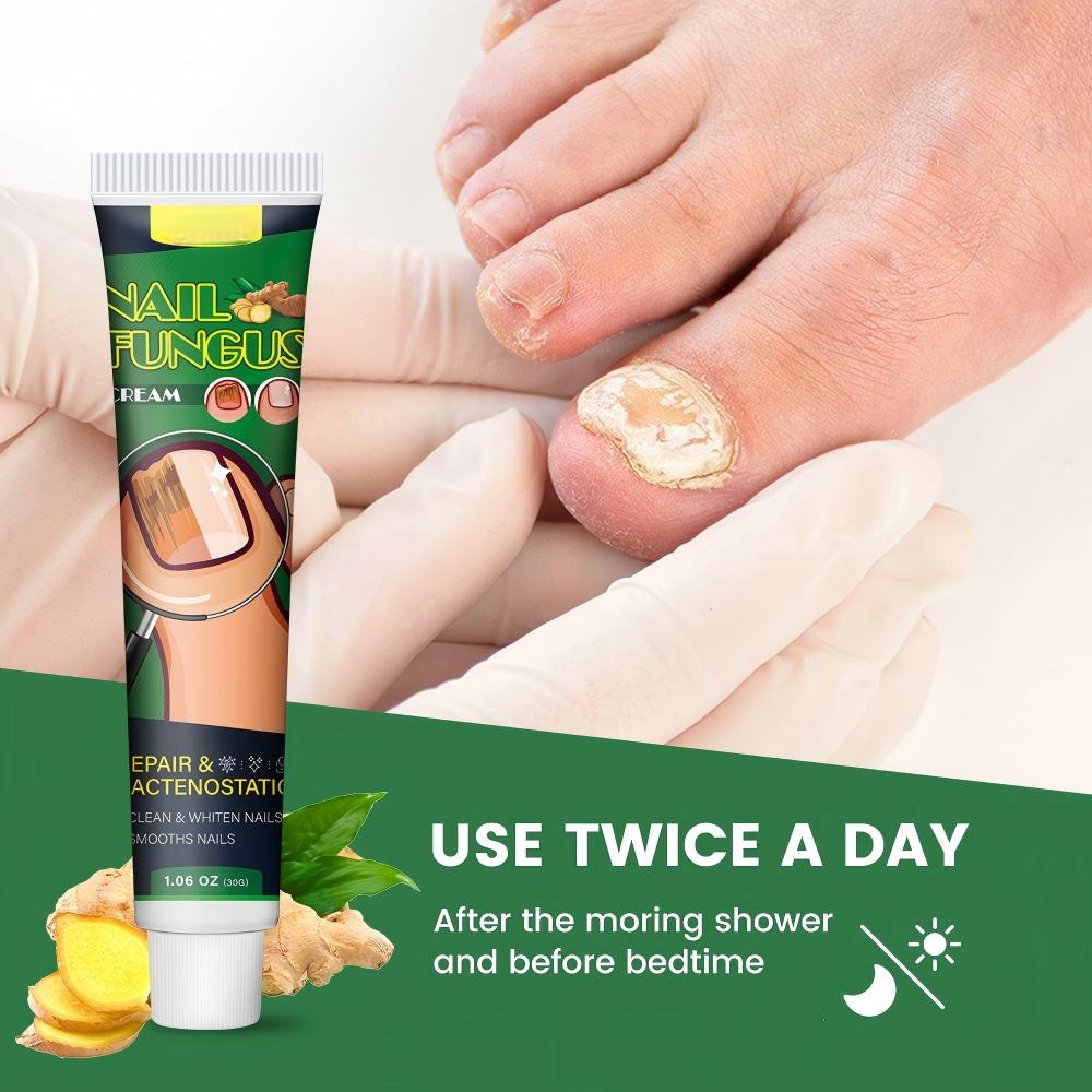Nail Fungus Cream