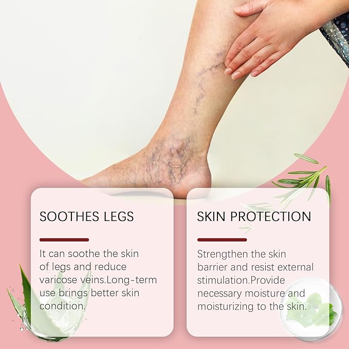 Varicose Veins Cream