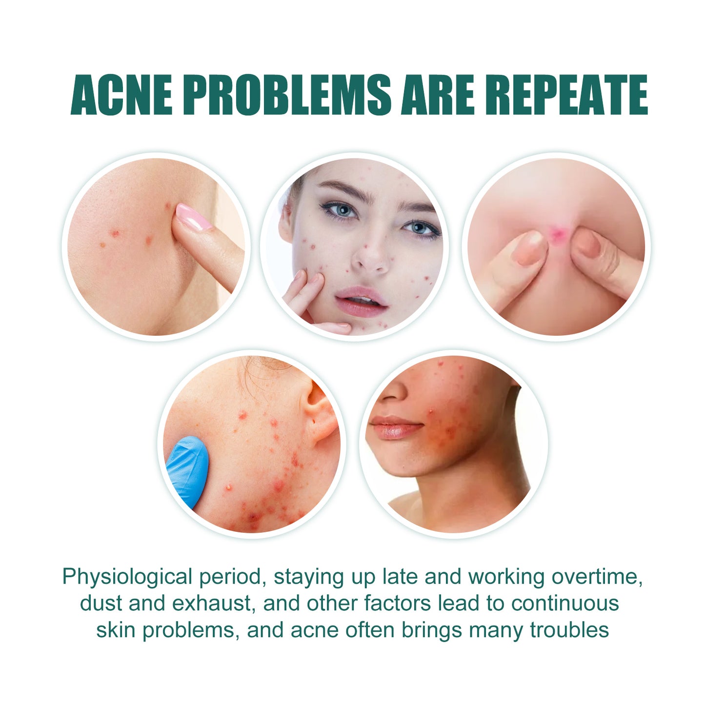 Invisible Pimple Patches