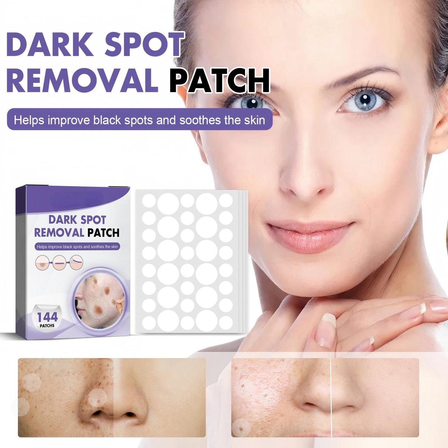 Wart Remover Patches