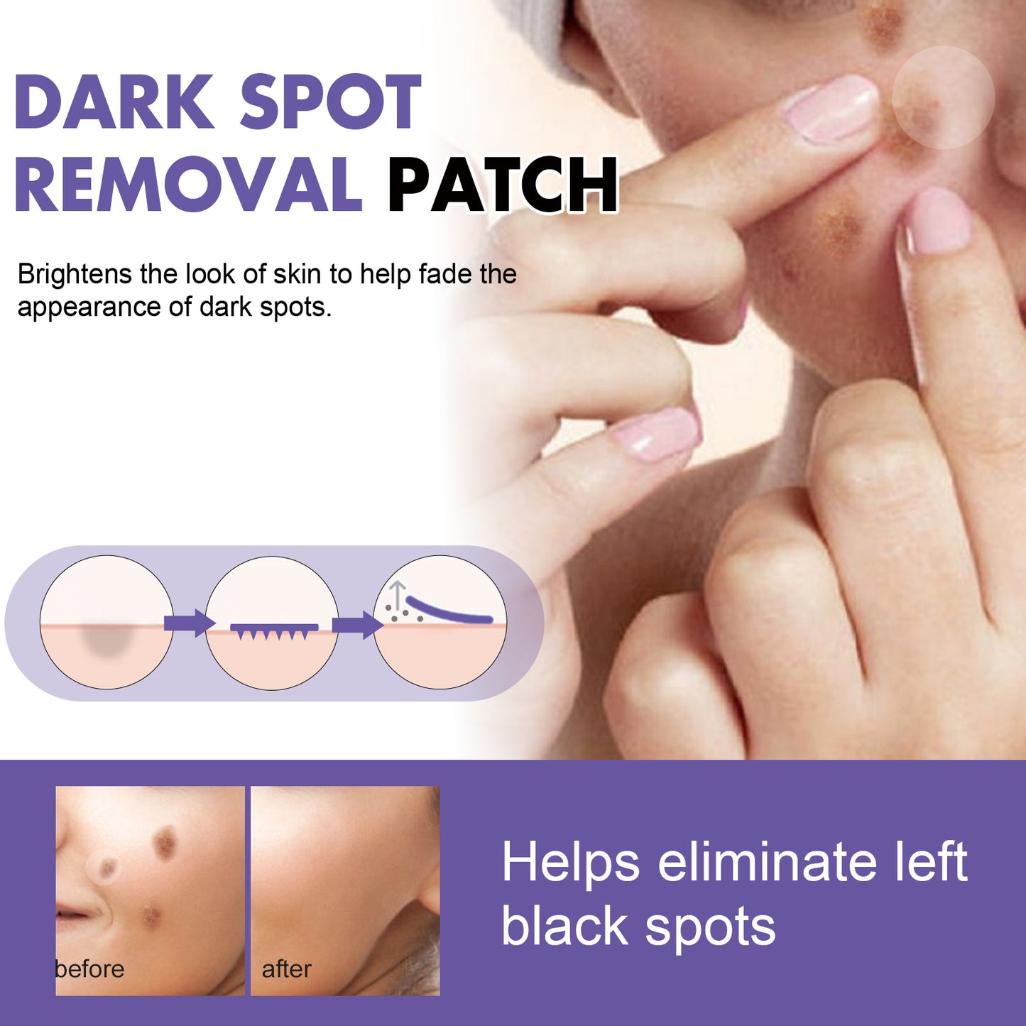 Wart Remover Patches