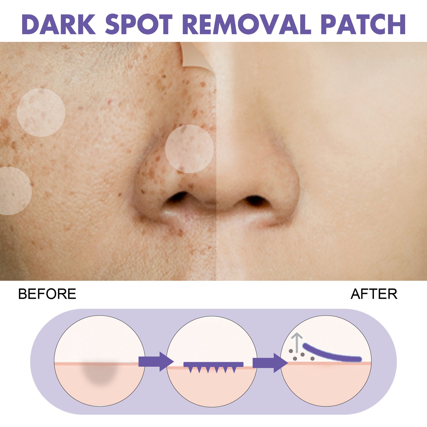 Wart Remover Patches