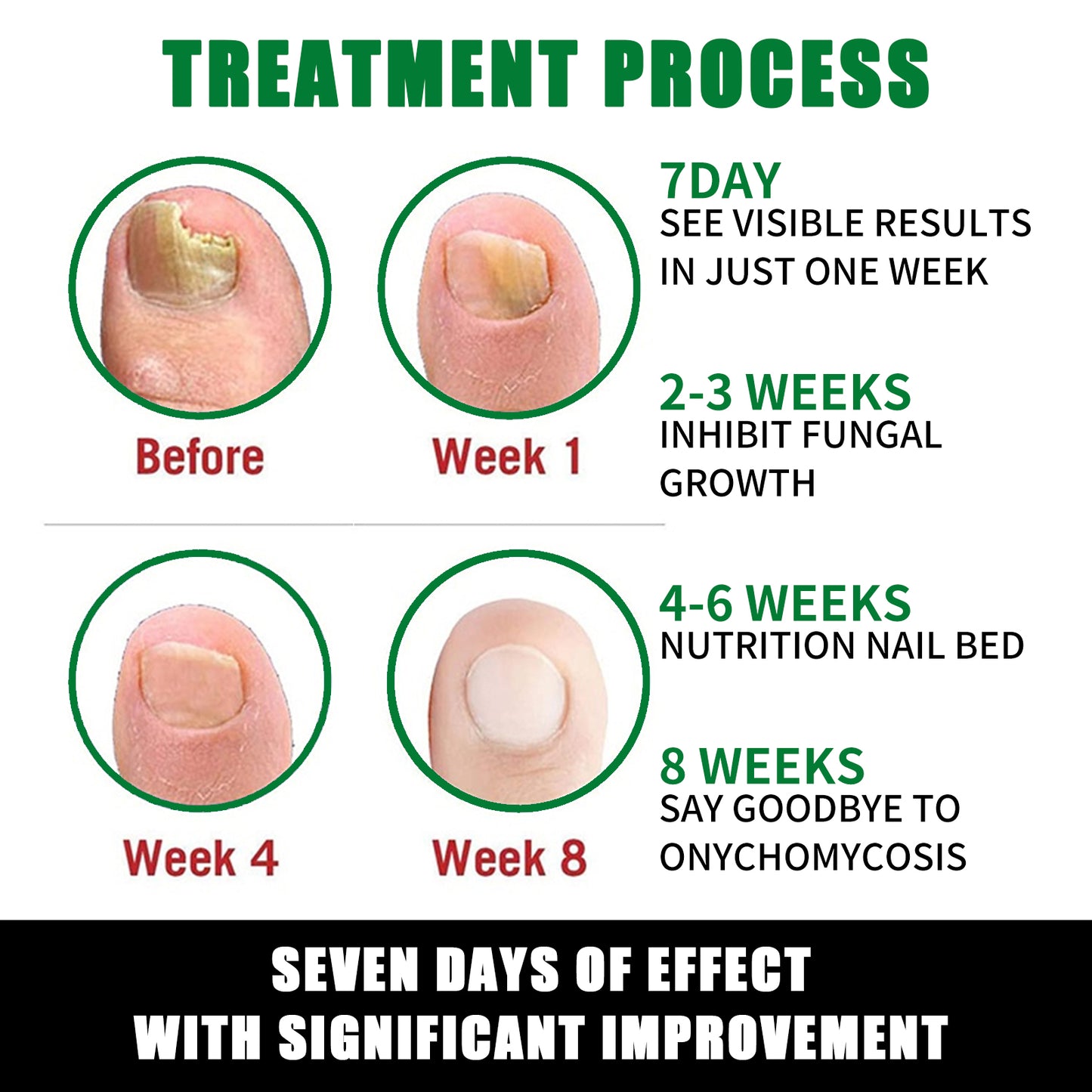 Ginger Nail Treatment