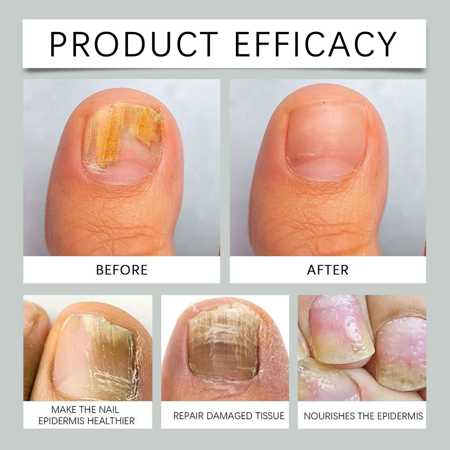 7 DAYS Tea Tree Ginger Nail Treatment