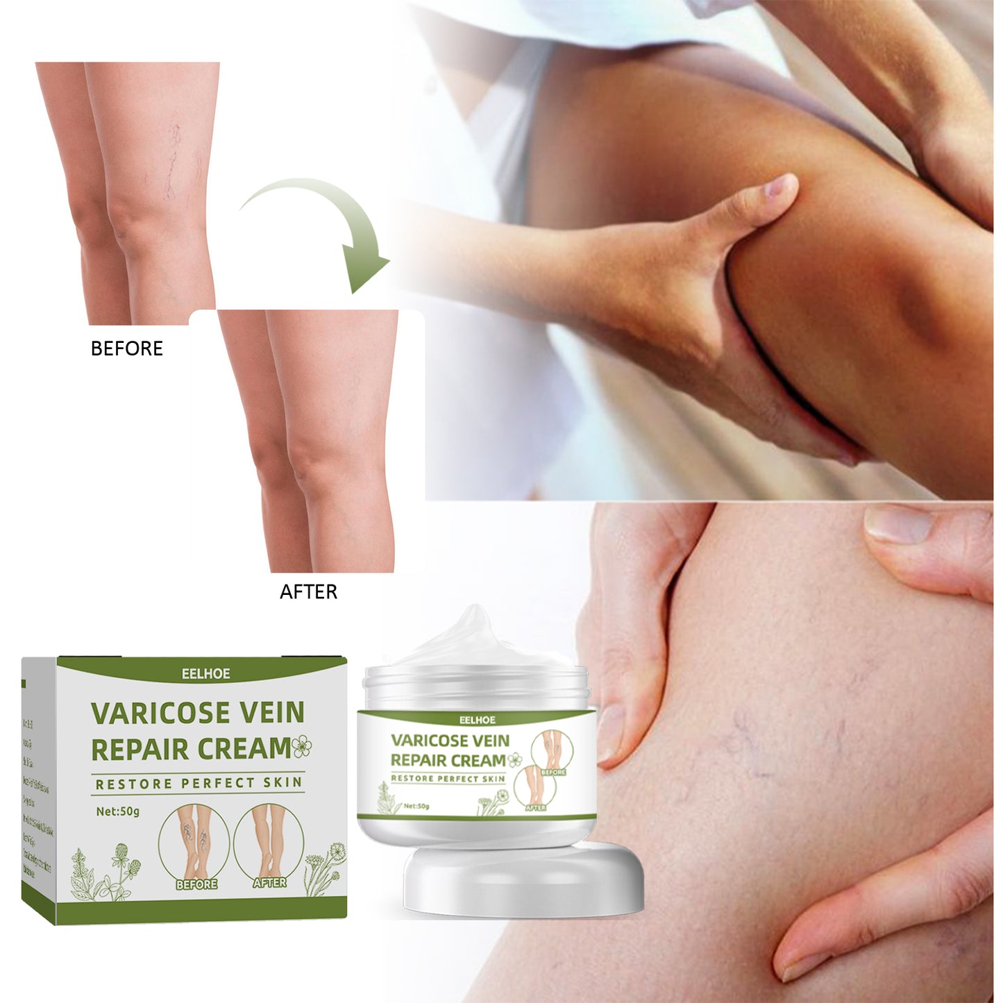 Varicose Veins Cream