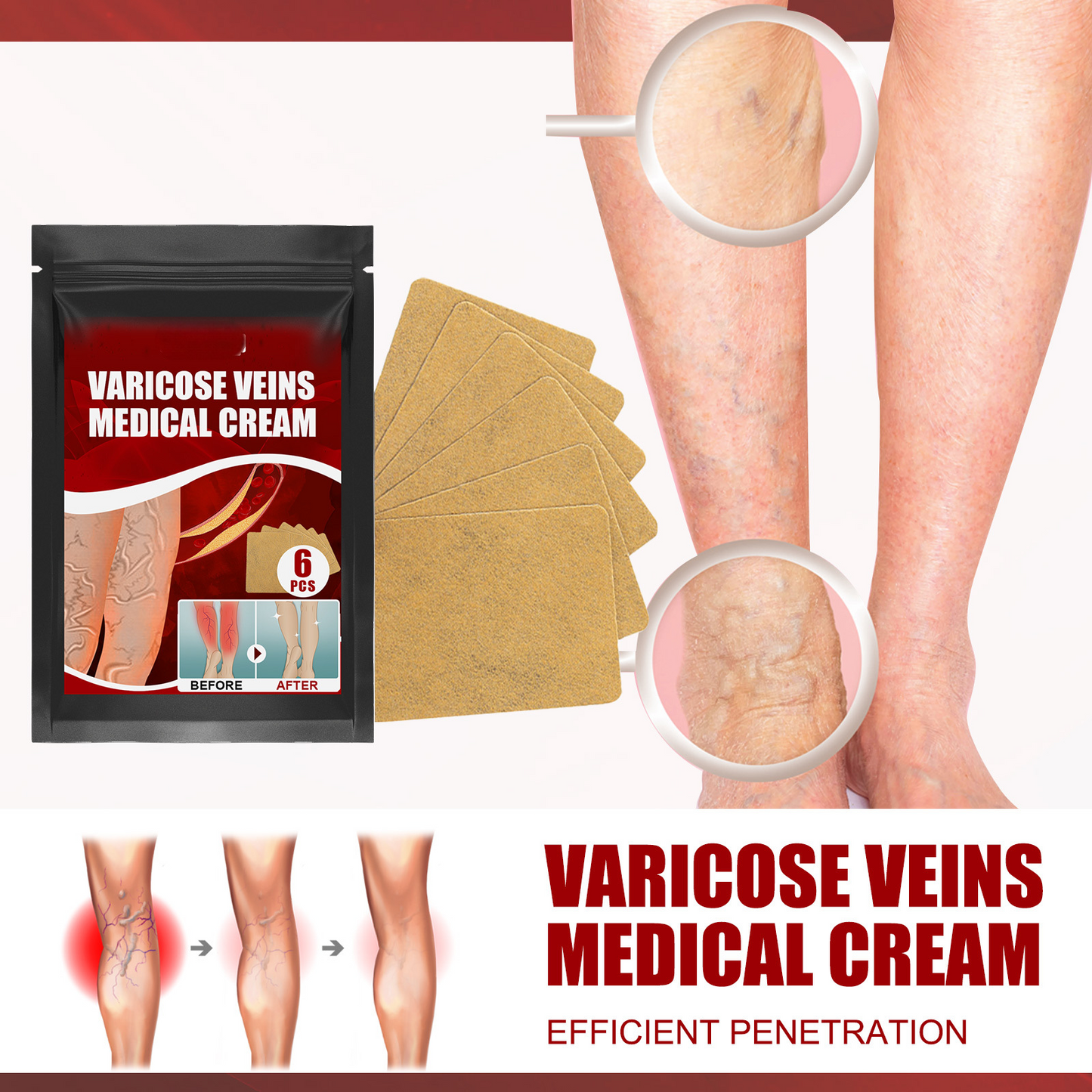 Varicose Vein Patch for Legs
