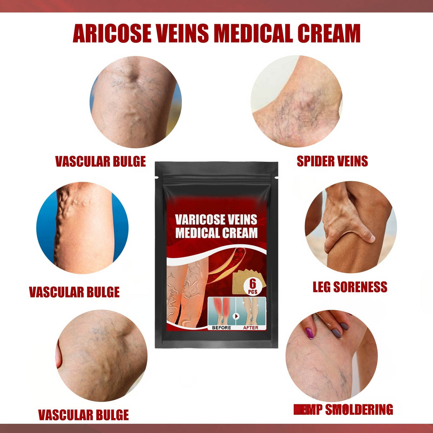 Varicose Vein Patch for Legs