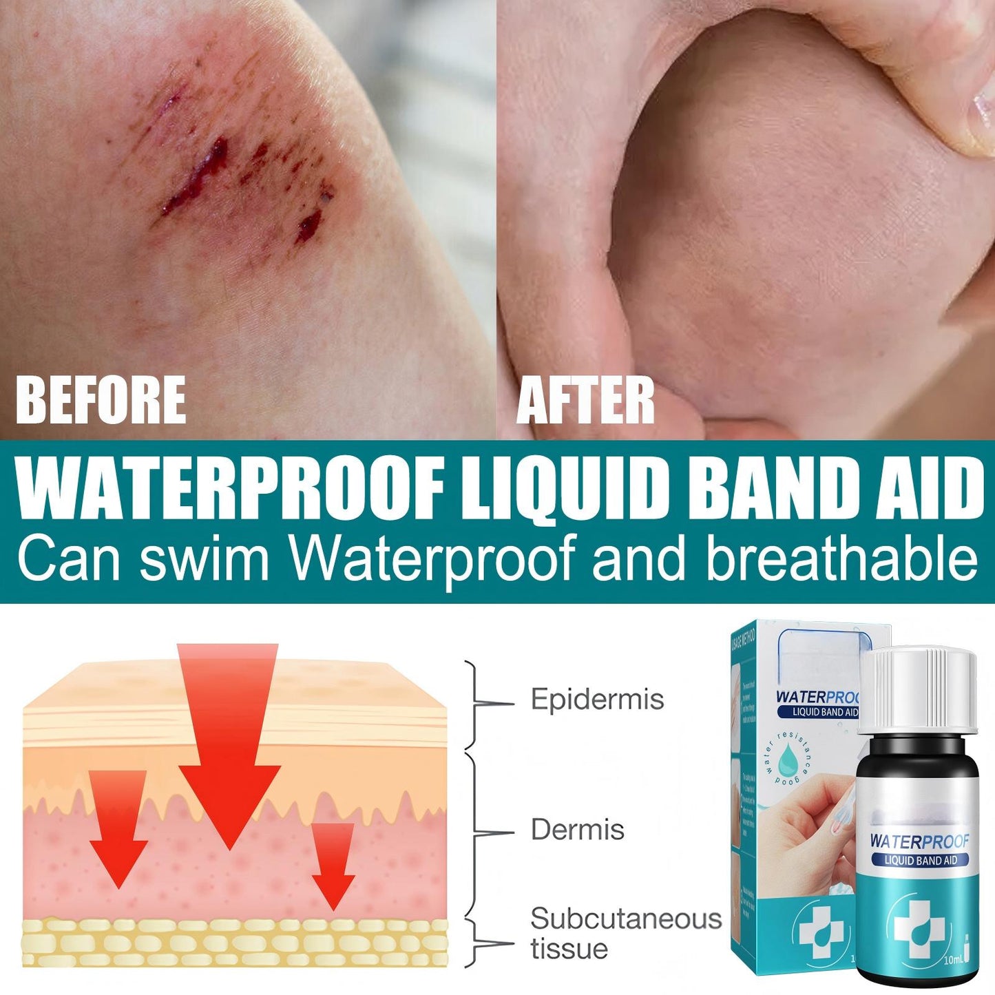 liquid bandage